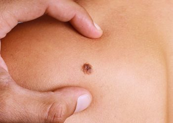 Citizens urged to go for regular cancer screening, testing